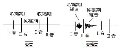 が 音 心臓 聞こえる の 心尖部のI音とII音（正常）、心基部のI音とII音（正常）、亢進したI音（異常）、I音の減弱（異常）